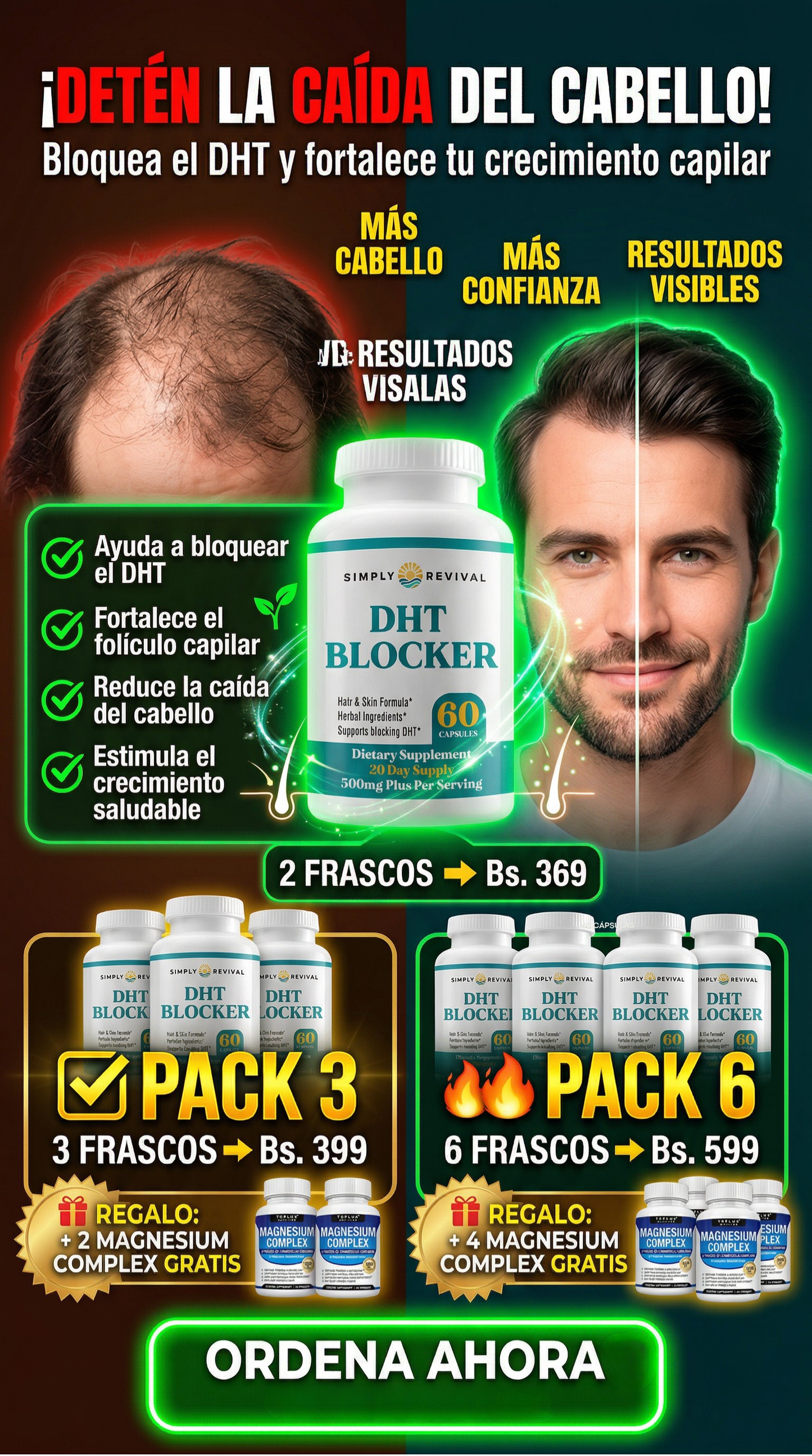 DHT BLOCKER - REACTIVA EL CRECIMIENTO DE TU CABELLO + MAGNESIUM COMPLEX